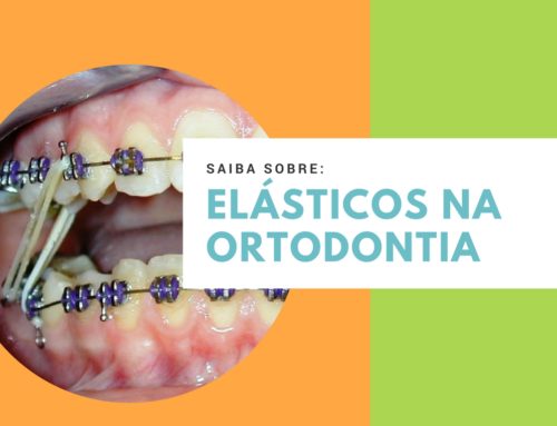 Elásticos em Ortodontia