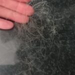 Paciente com queda de cabelo intensa antes do tratamento médico da Dra. Carolina Borba em Salvador.